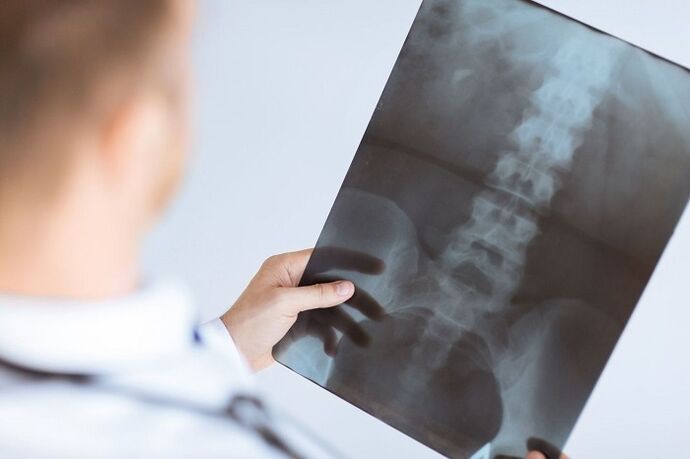 Opções de diagnóstico para osteocondrose lombar
