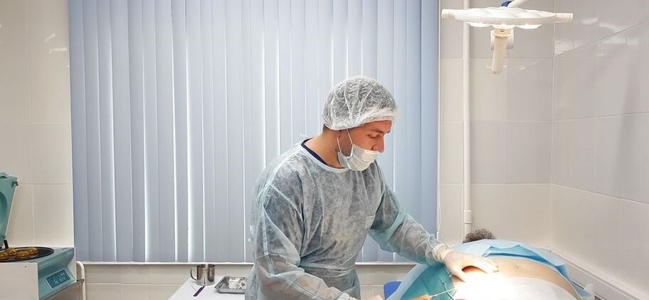 amostragem de tecido adiposo para terapia de SVF da osteoartrite da articulação do joelho