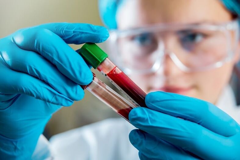 Exame de sangue completo para diagnosticar dor lombar