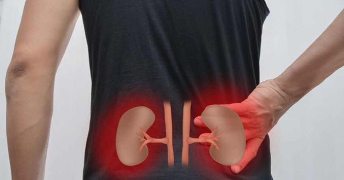 Inflamação dos rins pode causar dor lombar