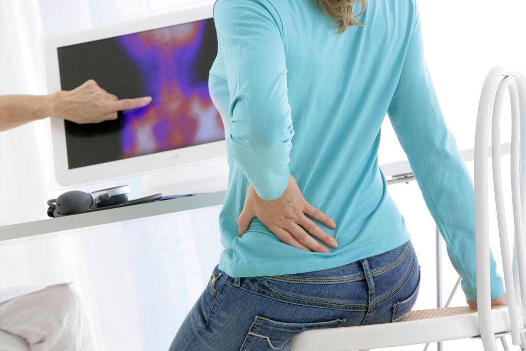 O tratamento da osteocondrose é prescrito com base no seu diagnóstico